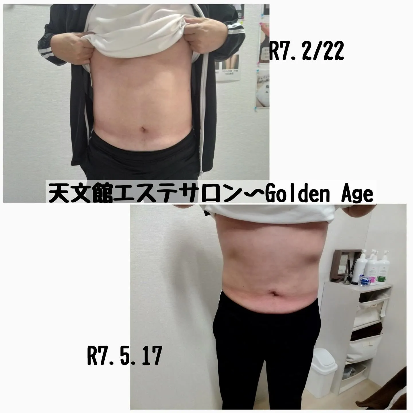 ﹨ 脂肪冷却🧊で理想のボディライン✨️ ∕