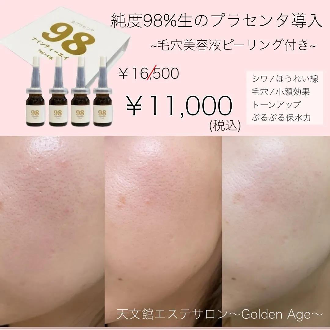 ﹨ 生プラセンタ 贅沢エステ 極上フェイシャル シワ改善 🫧...