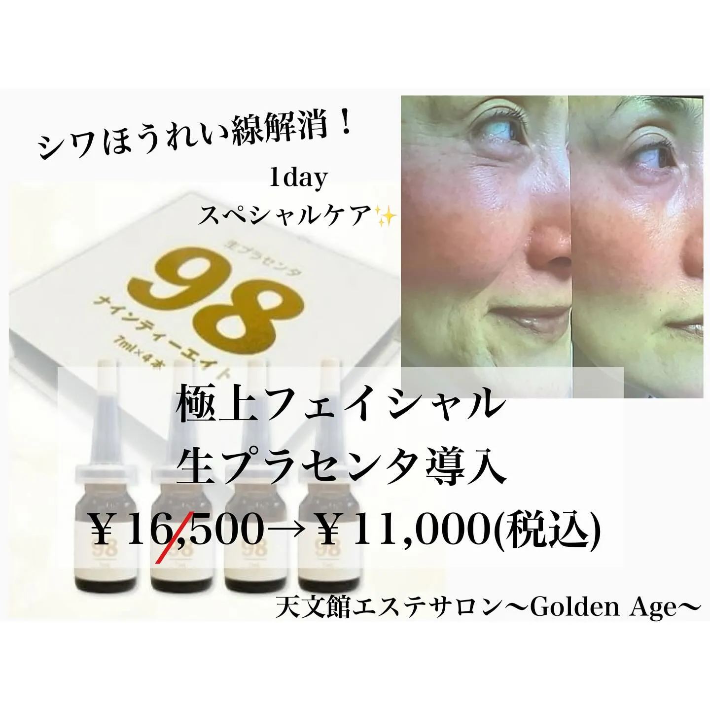 ﹨ 生プラセンタ 贅沢エステ 極上フェイシャル シワ改善 🫧...