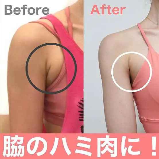 ﹨ 脇下脂肪冷却 脂肪冷却鹿児島市 二の腕痩せ 脂肪冷却キャ...