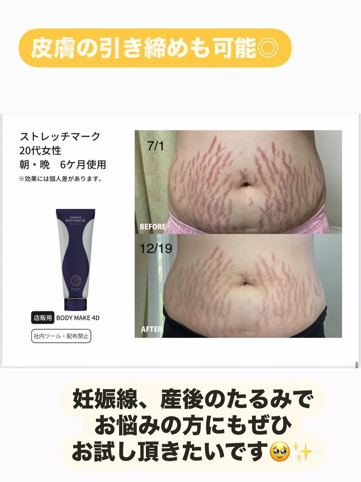 ﹨ 浮腫み改善 脚痩せ 痩身クリーム 筋トレクリーム鹿児島 ...