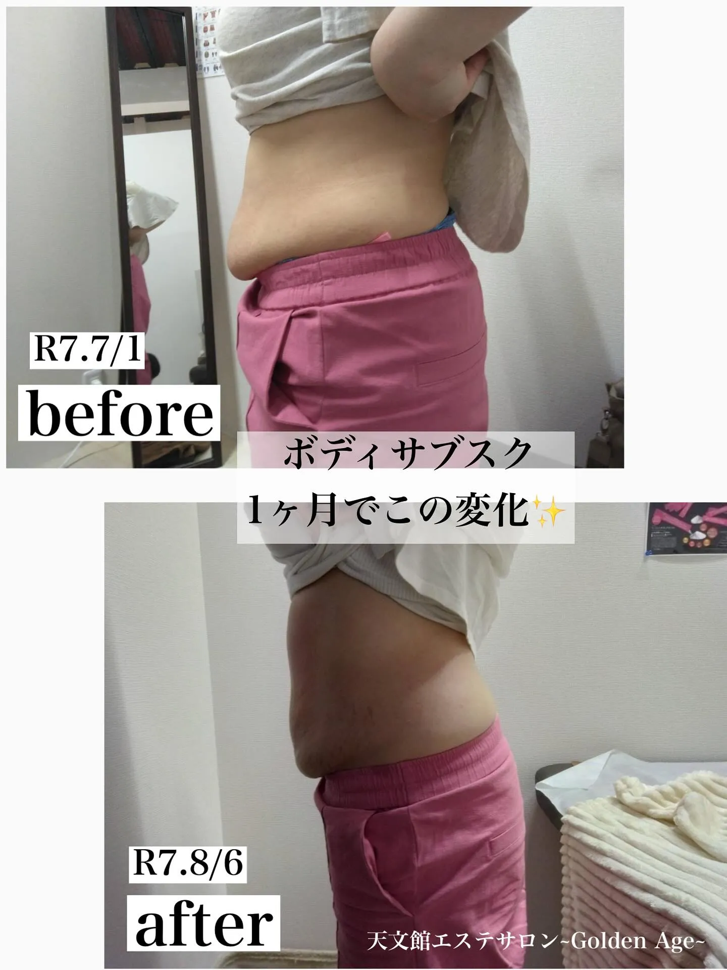 ﹨サブスクで短期集中ケア✨️ ∕ 脂肪冷却鹿児島 エステ通い...