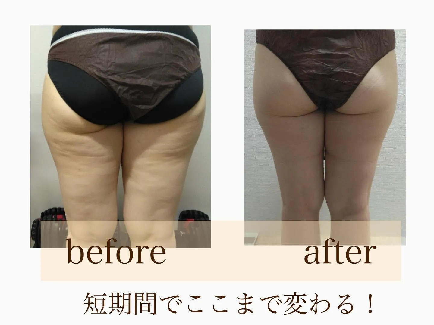 ﹨リバウンドしないダイエット✨️寝てるだけダイエット ∕
