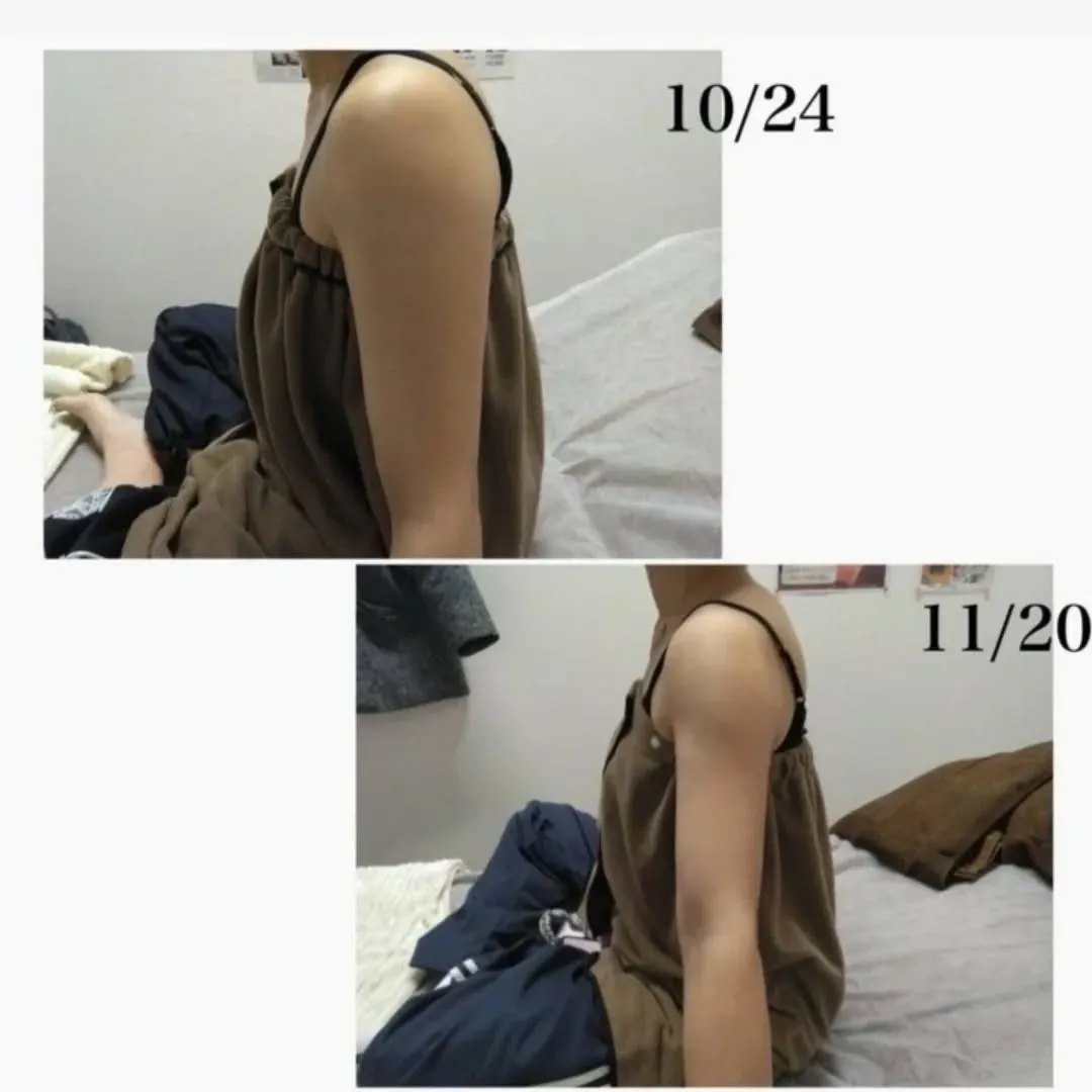 脂肪冷却＋脂肪溶解剤=最短でリバウンドしない痩身✨