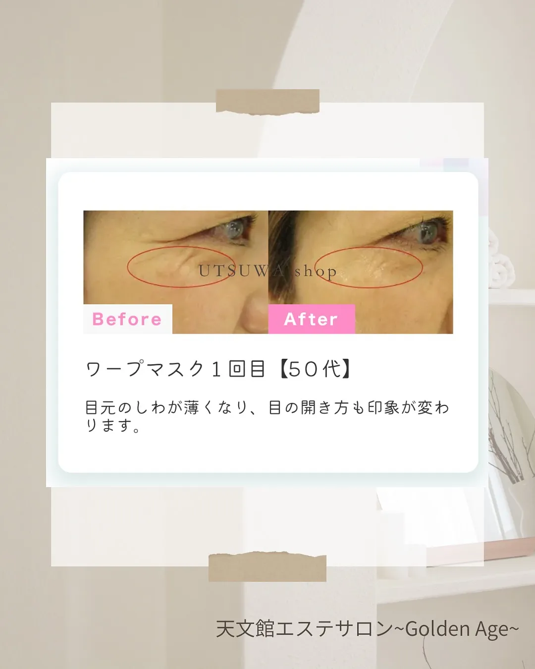 ﹨ 世界初‼️NMN配合ヒアルロン酸フルフェイスマスク✨️ ...