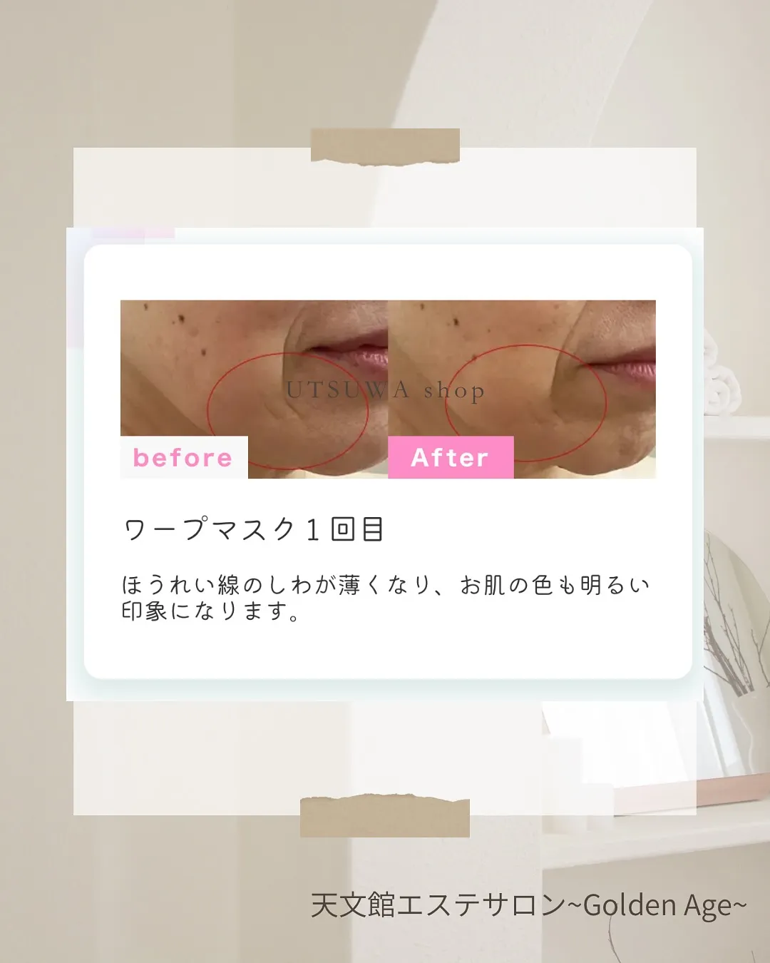 ﹨ 世界初‼️NMN配合ヒアルロン酸フルフェイスマスク✨️ ...