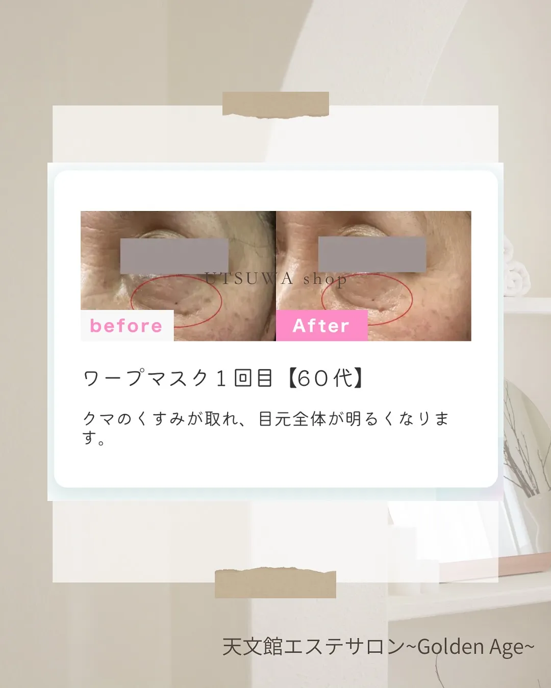 ﹨ 世界初‼️NMN配合ヒアルロン酸フルフェイスマスク✨️ ...