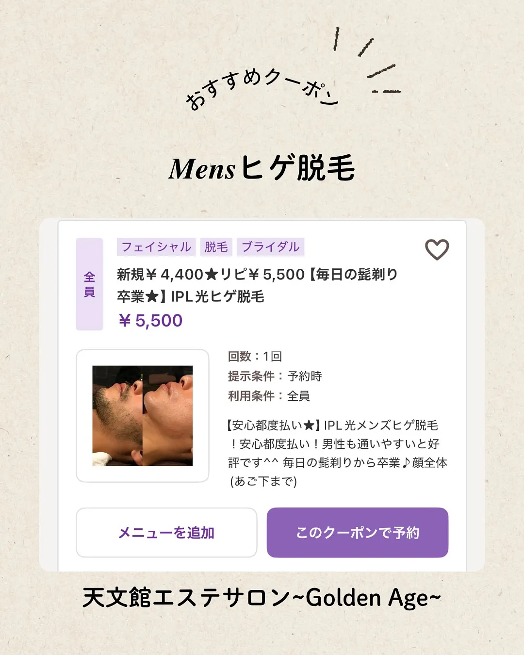 【脱】青ひげ！メンズ ヒゲ脱毛で毎日の髭剃りから卒業🎓✨️