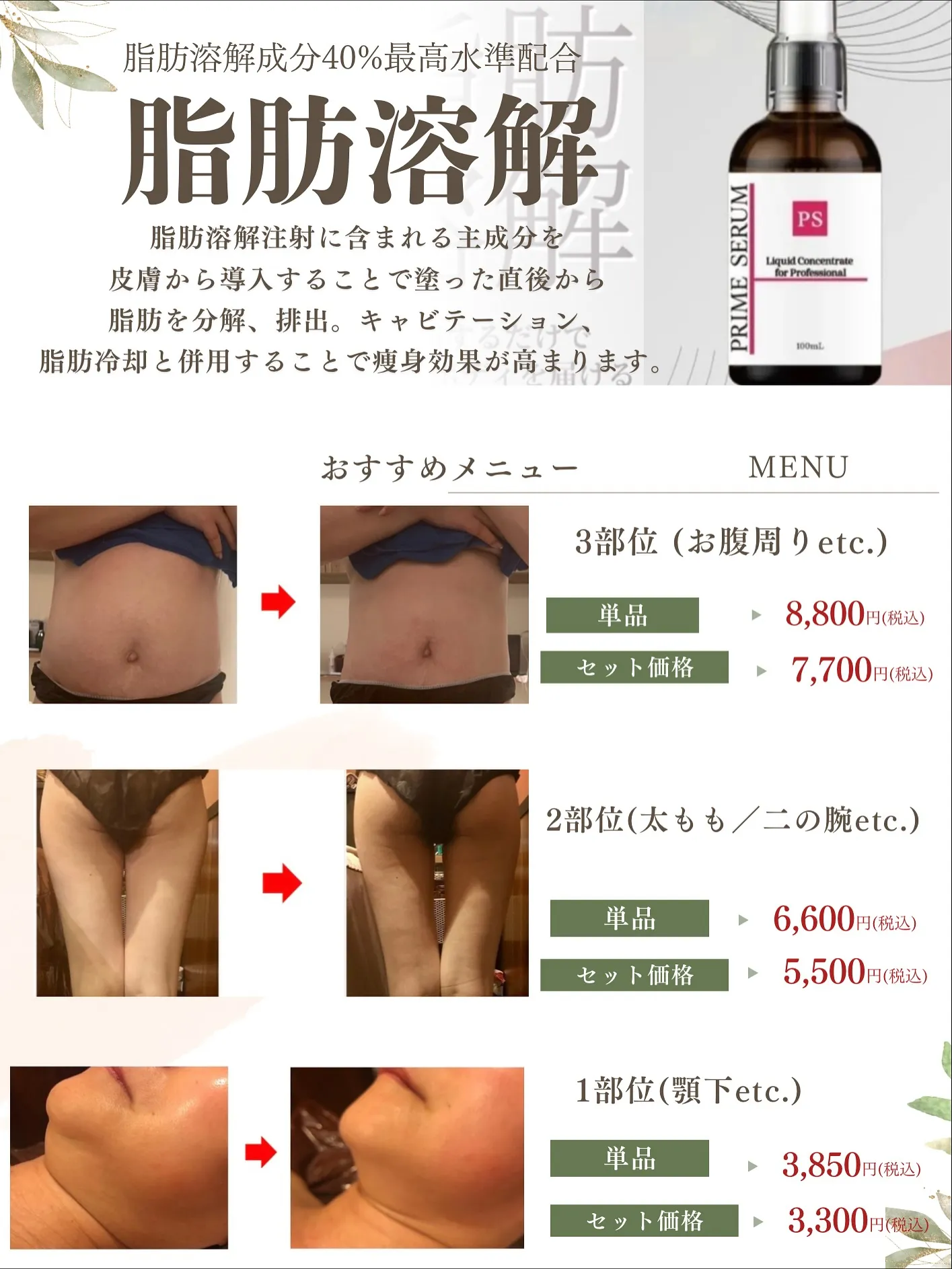 1日で小顔が叶う✨️脂肪溶解剤であご下肉撃退‼️