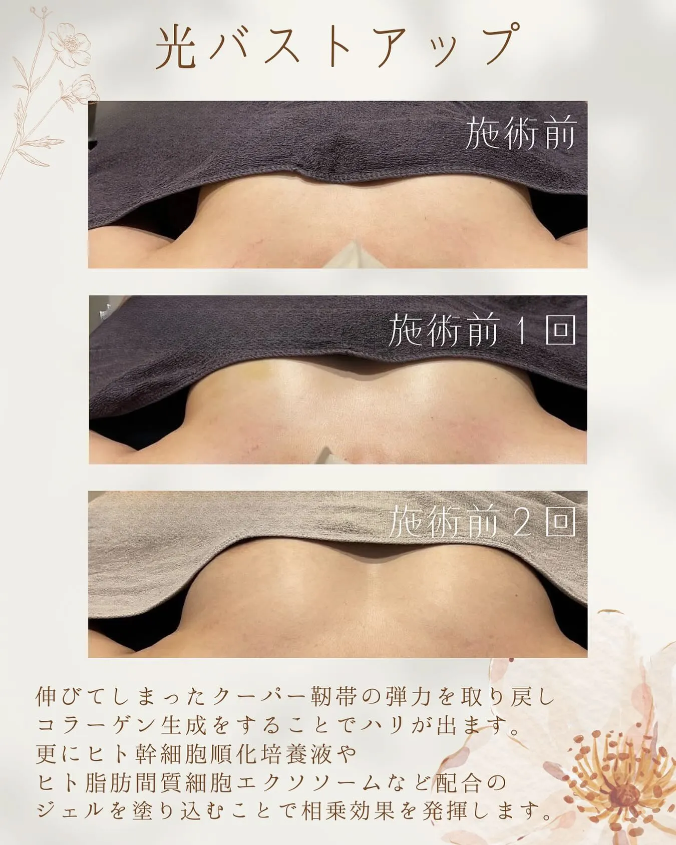 天文館でバストアップが叶う👏♥️✨️