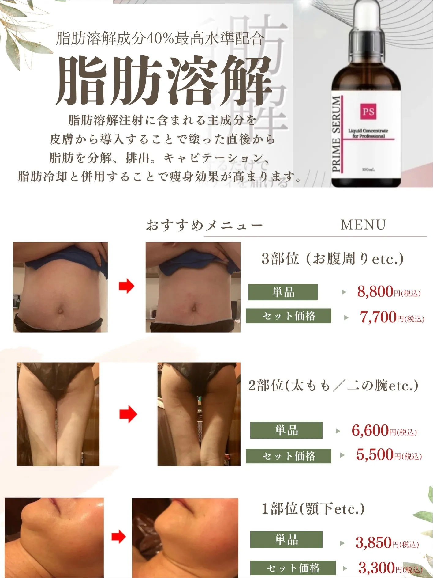 1日で小顔効果絶大✨️ 脂肪溶解剤で顎下肉がスッキリ🤍ꔛ‬