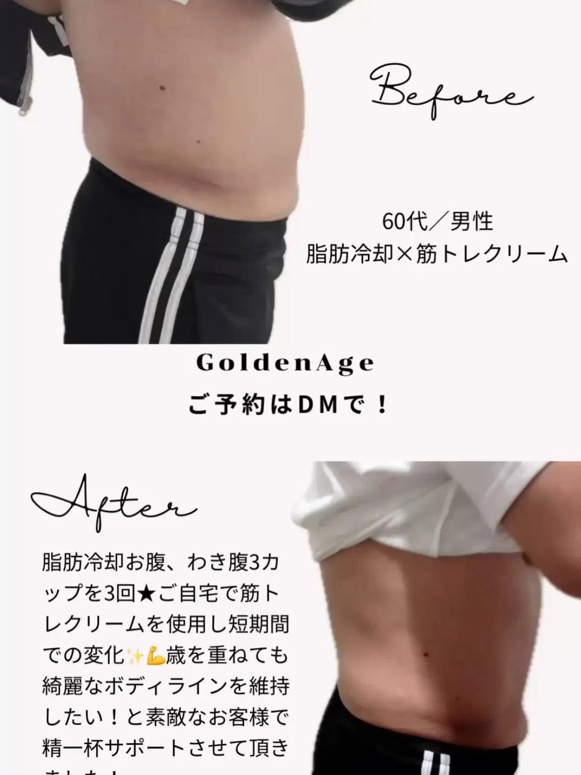 下腹肉撃退⚡️男性にも人気の痩身【脂肪冷却】🧊
