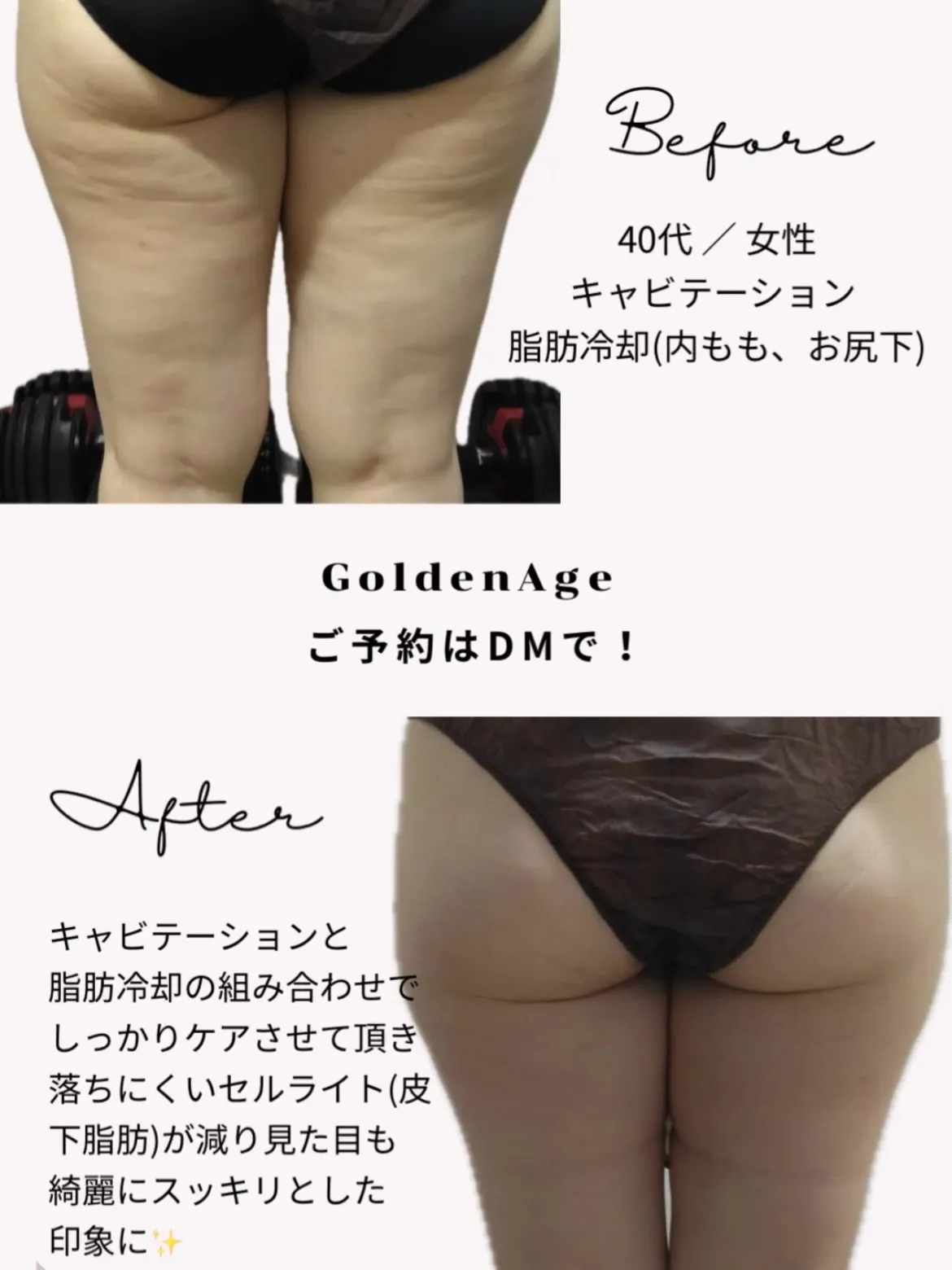 天文館痩身サロン 最強痩身プログラム🔥💪