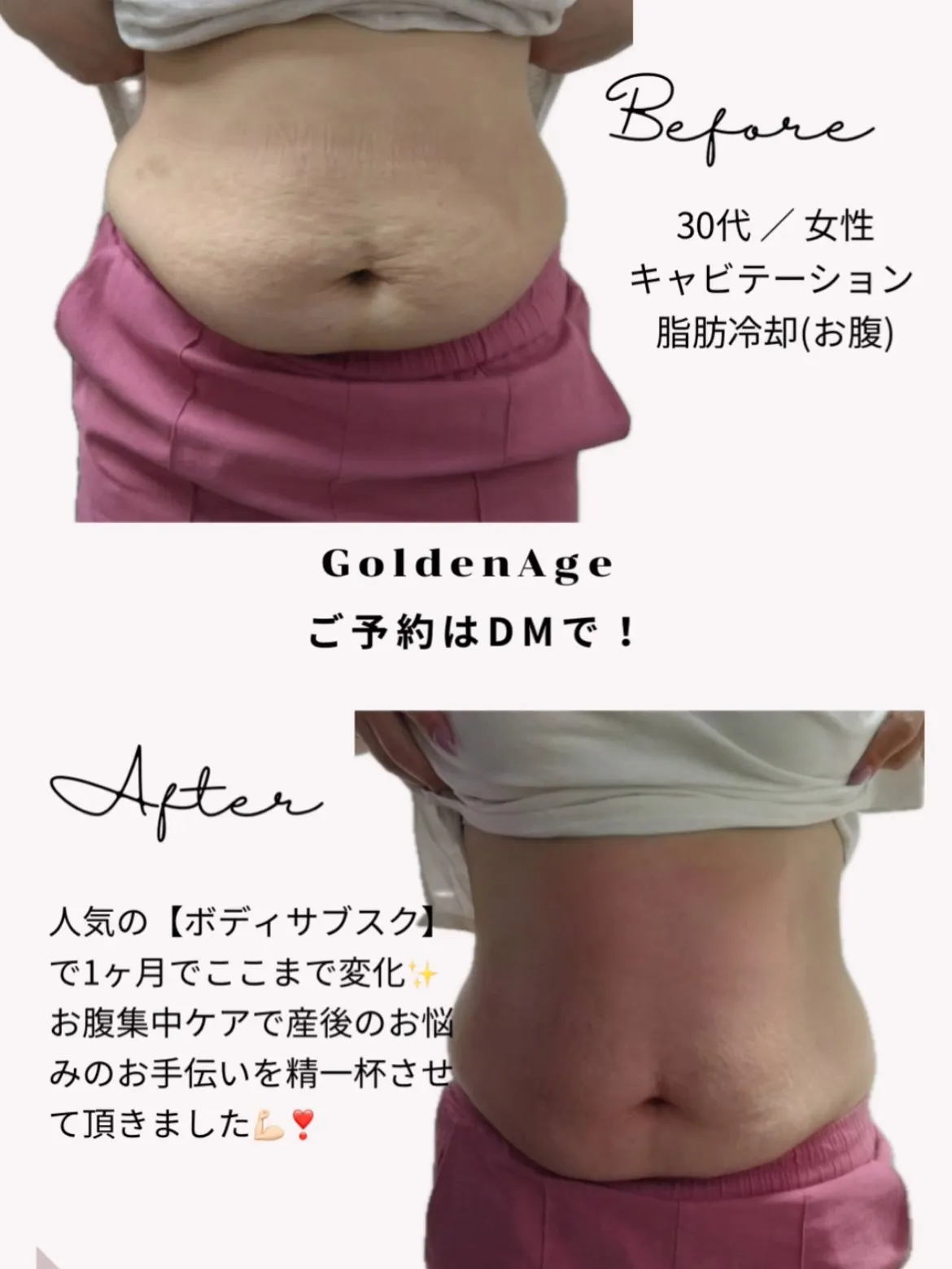 天文館痩身サロン 最強痩身プログラム🔥💪