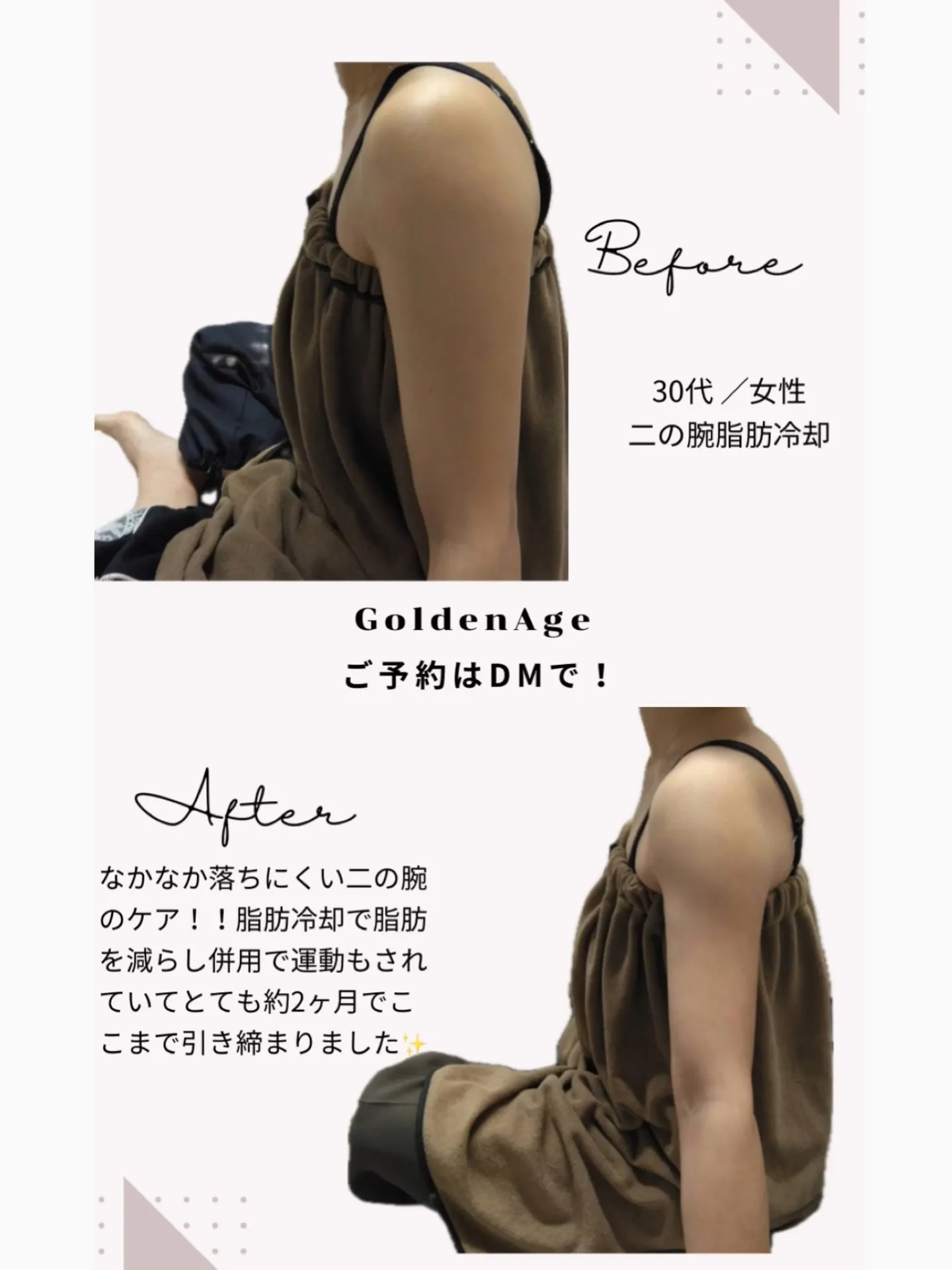 天文館痩身サロン 最強痩身プログラム🔥💪