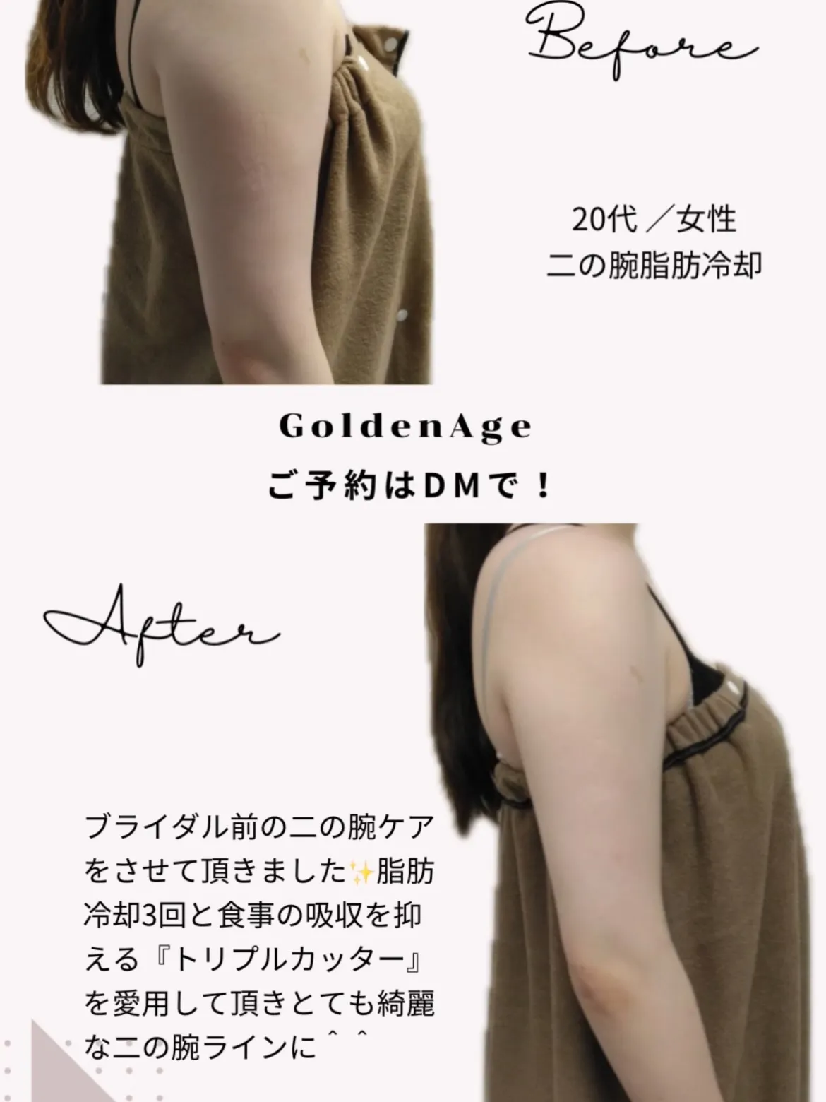 天文館痩身サロン 最強痩身プログラム🔥💪