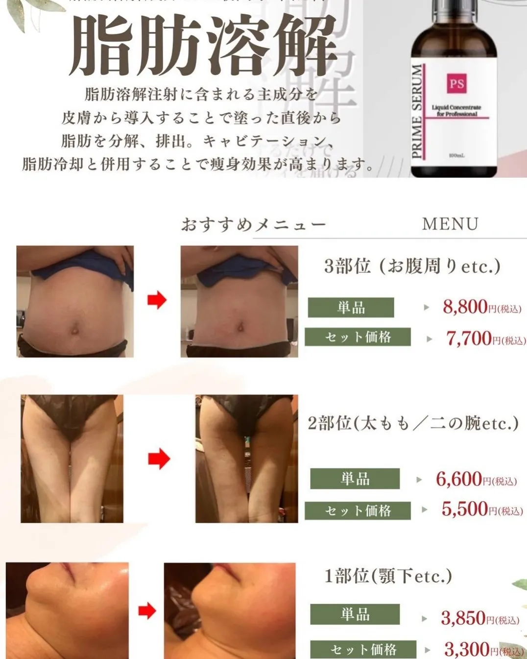 天文館で脂肪冷却の最強痩身に、小顔が作れてニキビ跡・毛穴・ほ...