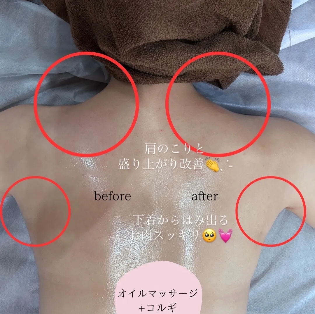 鹿児島市 天文館で脂肪冷却＋オイルマッサージで最強痩身術とリ...