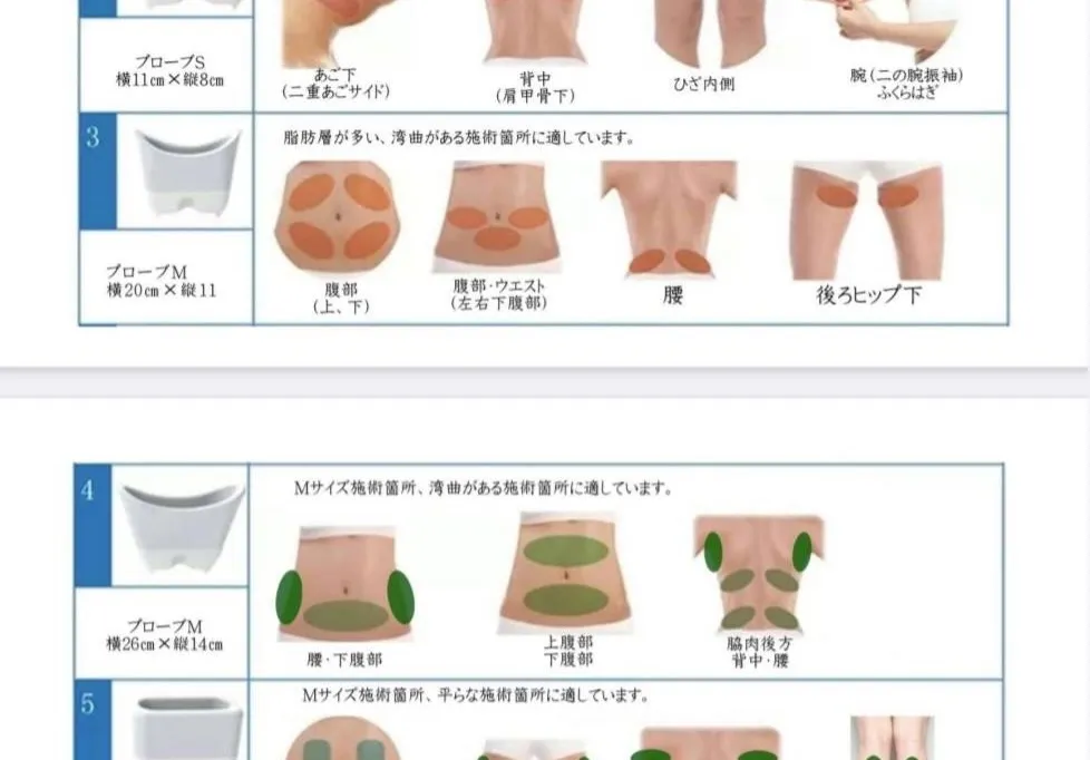 天文館で部分痩せなら脂肪冷却