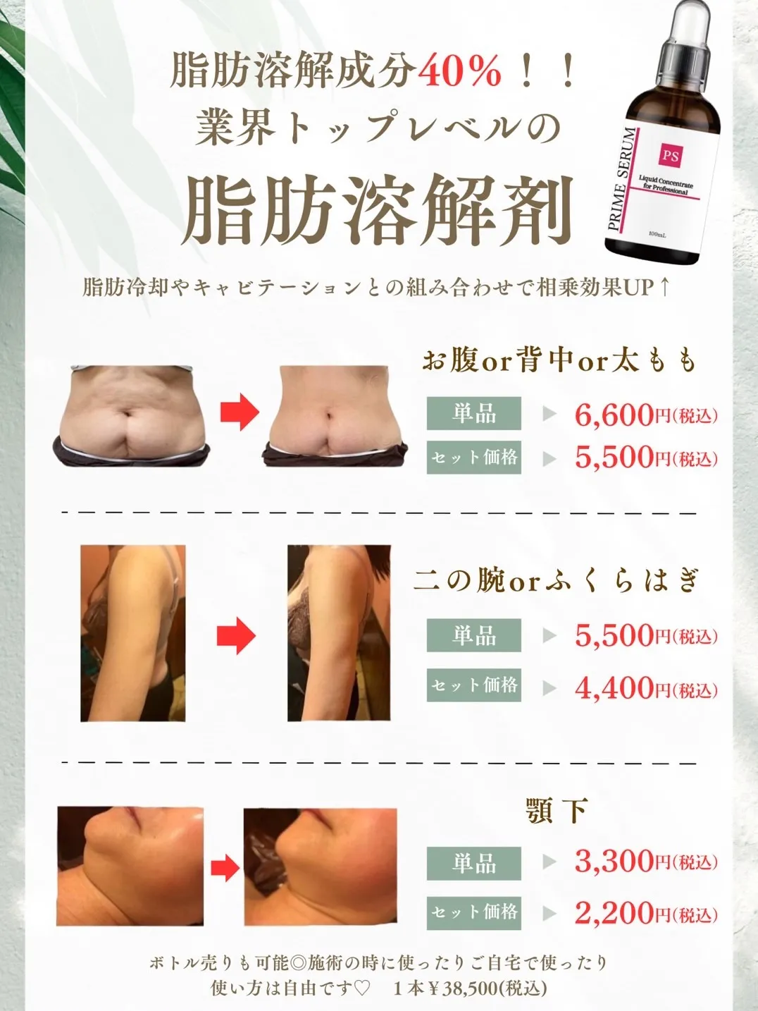 鹿児島市天文館で脂肪冷却やハーブピーリングがお得に受けられる...