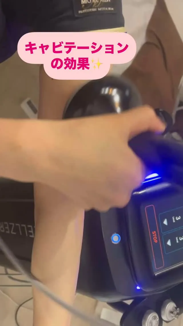 ﹨ キャビテーション鹿児島 痩身エステ鹿児島 キャビ鹿児島市...