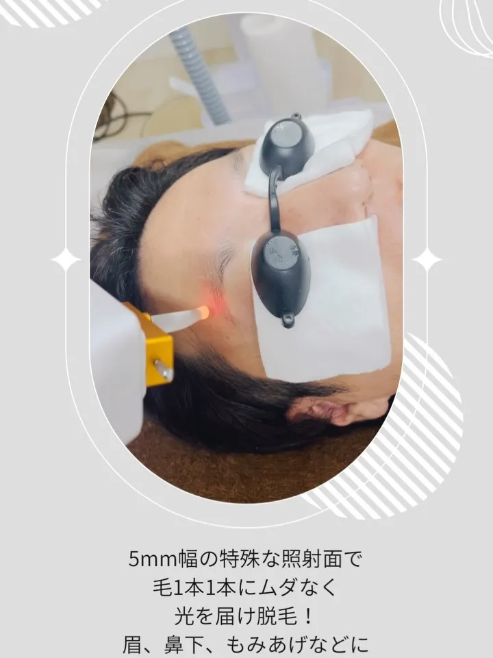 ﹨ 人気スポット脱毛★ 眉脱毛でお手入れ簡単♪理想の眉に✨️...